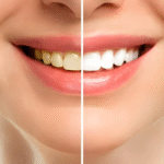 Unlock a Naturally Brighter Smile: The Truth About Teeth Whitening and How to Do It Safely
