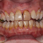 ProvaDent Review 2025: How I Finally Beat Chronic Bad Breath for Good