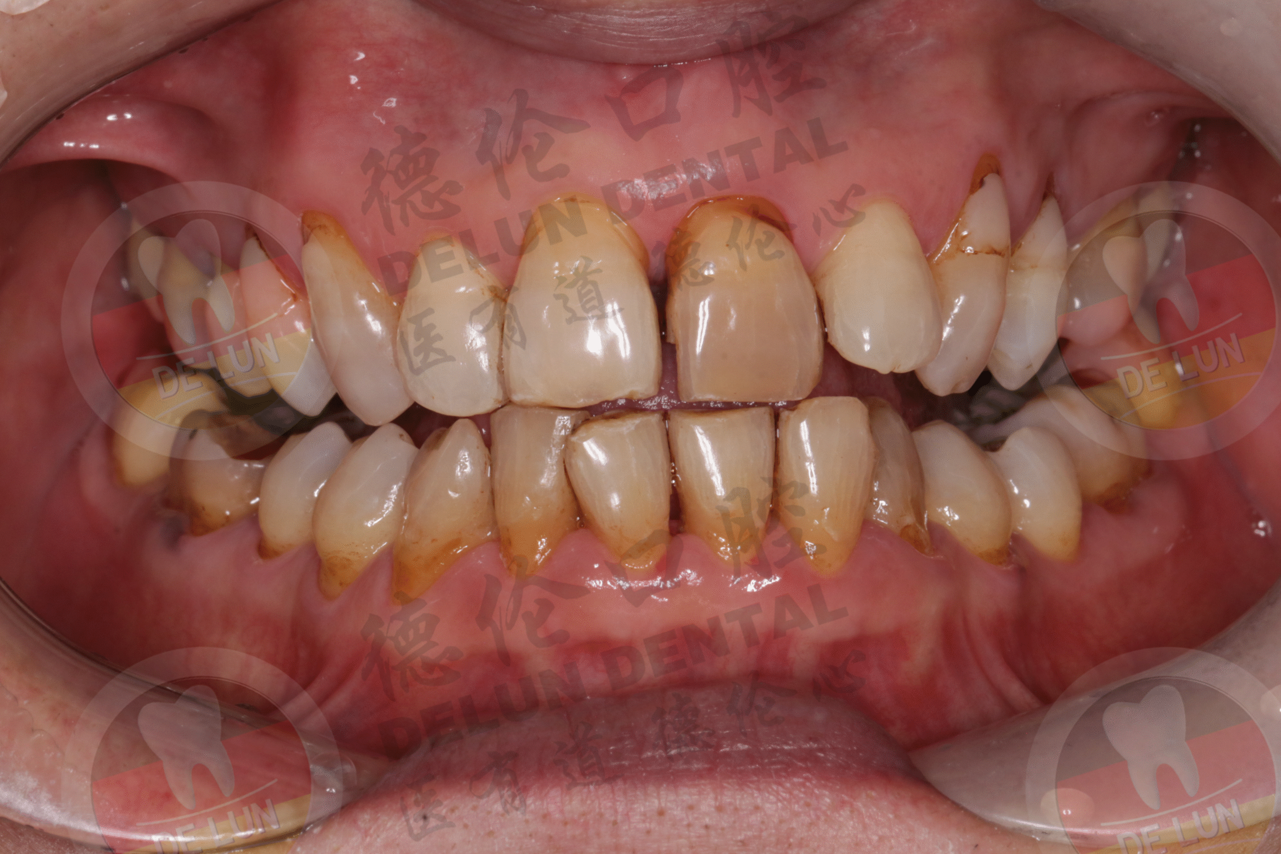 Read more about the article ProvaDent Review 2025: How I Finally Beat Chronic Bad Breath for Good